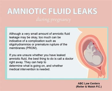 does amniotic fluid leak|Signs Of Leaking Amniotic Fluid Vs. Discharge: The Difference